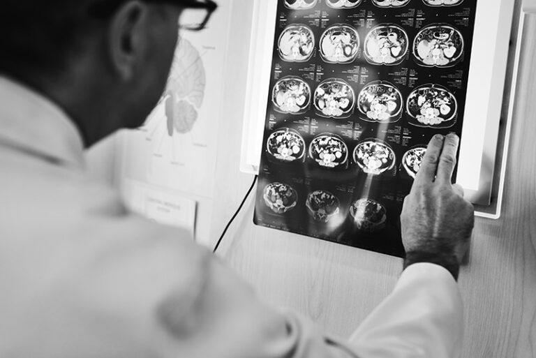 A doctor examines a series of brain scan images displayed on a lightbox, highlighting the importance of regular checkups and staying social for optimal brain health.